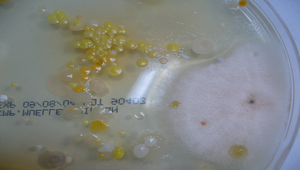 細菌培養照片10縮圖
