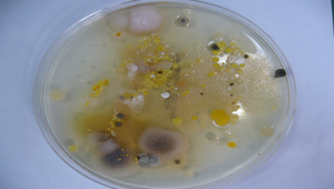 細菌培養照片3縮圖
